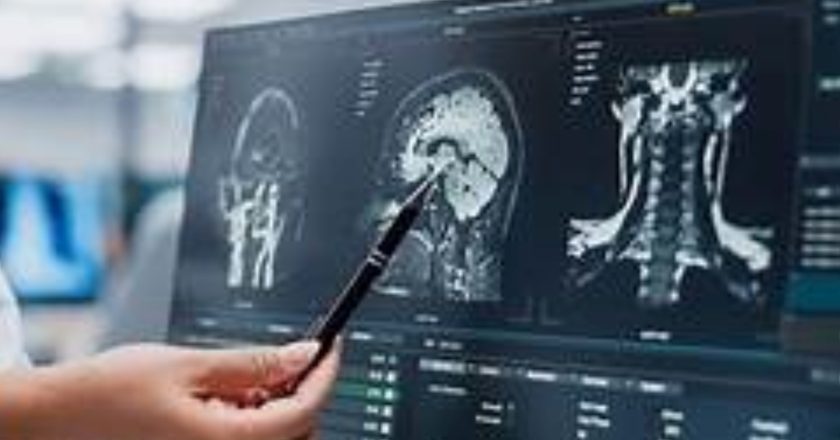 IMSS impulsa el conocimiento sobre enfermedades neurodegenerativas durante la Semana del Cerebro