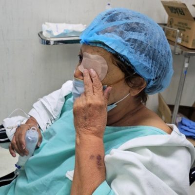 Recupera la vista paciente de 69 años con cataratas tras cirugía en UMAA del IMSS en Aguascalientes