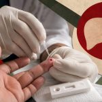 Refuerza IMSS Nayarit prevención y detección oportuna de hepatitis para proteger la salud