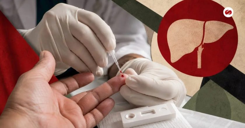 Refuerza IMSS Nayarit prevención y detección oportuna de hepatitis para proteger la salud